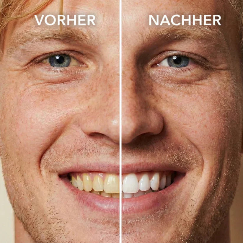 Tooth Polish - Instant Clean Smile